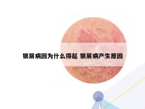 银屑病因为什么得起 银屑病产生原因