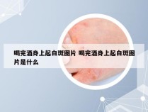 喝完酒身上起白斑图片 喝完酒身上起白斑图片是什么