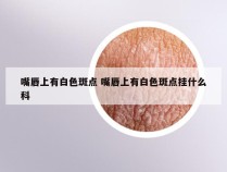 嘴唇上有白色斑点 嘴唇上有白色斑点挂什么科