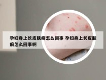 孕妇身上长皮肤癣怎么回事 孕妇身上长皮肤癣怎么回事啊