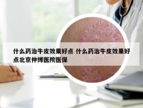 什么药治牛皮效果好点 什么药治牛皮效果好点北京仲博医院医保