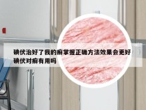 碘伏治好了我的癣掌握正确方法效果会更好 碘伏对癣有用吗