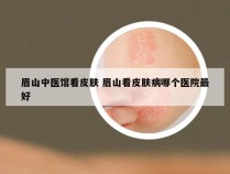 眉山中医馆看皮肤 眉山看皮肤病哪个医院最好