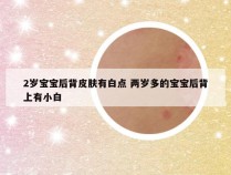 2岁宝宝后背皮肤有白点 两岁多的宝宝后背上有小白