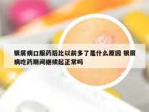 银屑病口服药后比以前多了是什么原因 银屑病吃药期间继续起正常吗