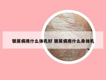 银屑病用什么体乳好 银屑病用什么身体乳