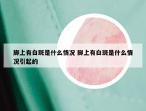 脚上有白斑是什么情况 脚上有白斑是什么情况引起的