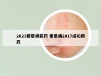 2023银屑病新药 银屑病2017成功新药