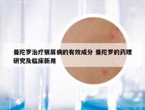 曼陀罗治疗银屑病的有效成分 曼陀罗的药理研究及临床新用