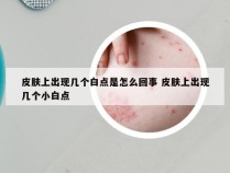 皮肤上出现几个白点是怎么回事 皮肤上出现几个小白点