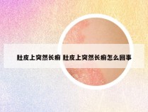 肚皮上突然长癣 肚皮上突然长癣怎么回事