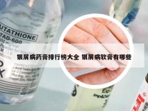 银屑病药膏排行榜大全 银屑病软膏有哪些