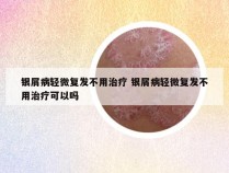 银屑病轻微复发不用治疗 银屑病轻微复发不用治疗可以吗