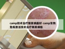 camp技术治疗银屑病最好 camp生物免疫激活技术治疗银屑病格