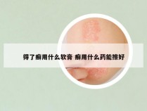 得了癣用什么软膏 癣用什么药能擦好