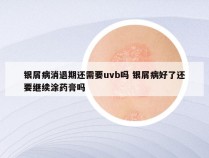 银屑病消退期还需要uvb吗 银屑病好了还要继续涂药膏吗