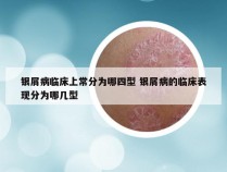 银屑病临床上常分为哪四型 银屑病的临床表现分为哪几型