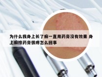 为什么我身上长了癣一直用药膏没有效果 身上癣擦药膏很疼怎么回事