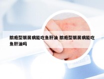 脓疱型银屑病能吃鱼肝油 脓疱型银屑病能吃鱼肝油吗