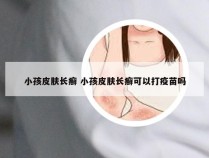 小孩皮肤长癣 小孩皮肤长癣可以打疫苗吗