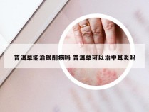 普洱草能治银削病吗 普洱草可以治中耳炎吗