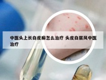 中医头上长白皮癣怎么治疗 头皮白屑风中医治疗