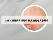 人参对银屑病有帮助吗 银屑病能吃人参果吗