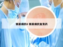 银屑病抗0 银屑病抗复发药