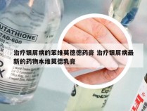 治疗银屑病的苯维莫德德药膏 治疗银屑病最新的药物本维莫德乳膏