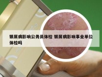 银屑病影响公务员体检 银屑病影响事业单位体检吗