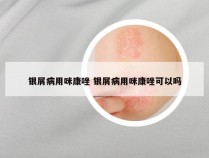 银屑病用咪康唑 银屑病用咪康唑可以吗