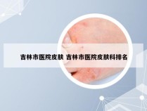 吉林市医院皮肤 吉林市医院皮肤科排名