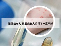 银屑病老人 银屑病老人家得了一直不好