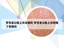 梦见老公脸上长白癜风 梦见老公脸上长斑瘦了有皱纹