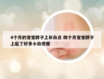 4个月的宝宝脖子上长白点 四个月宝宝脖子上起了好多小白疙瘩