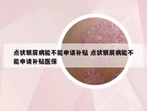 点状银屑病能不能申请补贴 点状银屑病能不能申请补贴医保