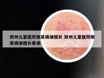 郑州儿童医院银屑病谁擅长 郑州儿童医院银屑病谁擅长看病