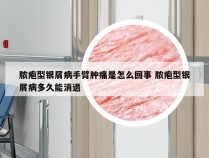 脓疱型银屑病手臂肿痛是怎么回事 脓疱型银屑病多久能消退