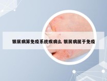 银屑病算免疫系统疾病么 银屑病属于免疫