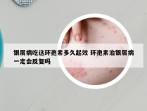 银屑病吃这环孢素多久起效 环孢素治银屑病一定会反复吗