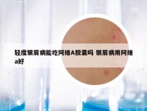 轻度银屑病能吃阿维A胶囊吗 银屑病用阿维a好