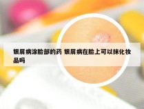 银屑病涂脸部的药 银屑病在脸上可以抹化妆品吗