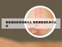 银屑病皮肤保湿用什么 银屑病保湿乳用什么好