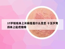 15岁娃娃身上长癣是是什么意思 十五岁男孩身上起疙瘩痒