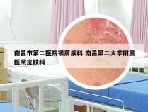 南昌市第二医院银屑病科 南昌第二大学附属医院皮肤科