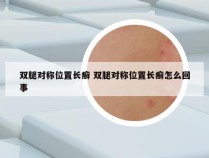 双腿对称位置长癣 双腿对称位置长癣怎么回事