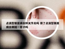 点滴型银屑病会转关节炎吗 得了点滴型银屑病会跟随一辈子吗