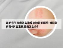 四岁有牛皮癣怎么治疗比较好的医院 谁能告诉我4岁宝宝银屑病怎么办?