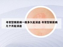 寻常型银屑病一般多久能消退 寻常型银屑病几个月能消退