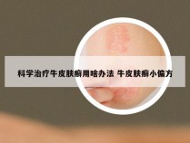 科学治疗牛皮肤癣用啥办法 牛皮肤癣小偏方